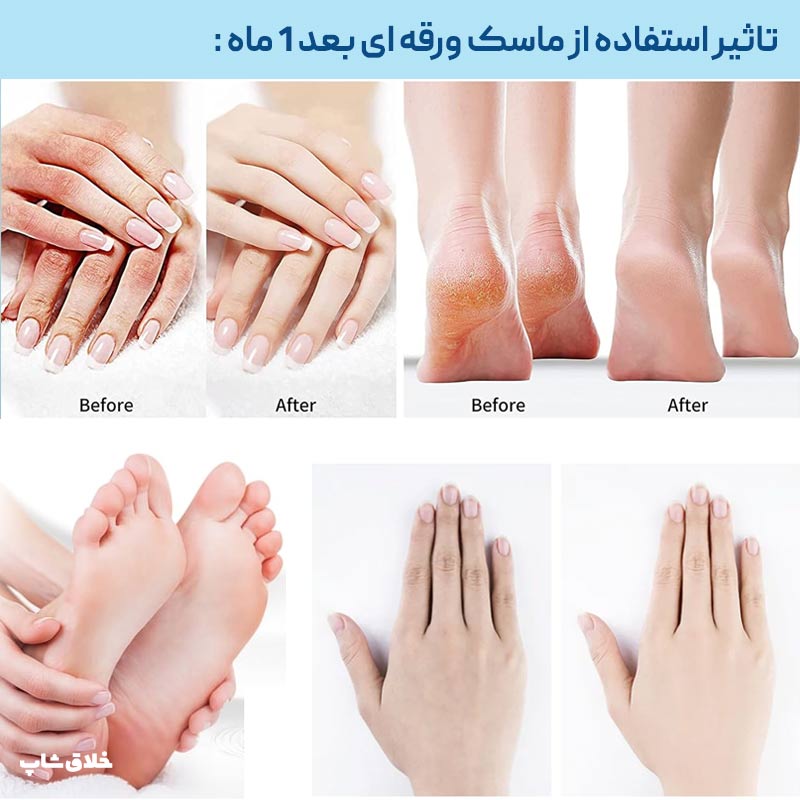 ماسک دست و پا ورقه‌ای EXGYAN با عصاره شیر بز